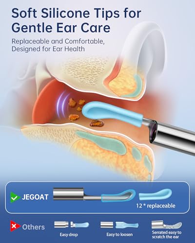 Ear Wax Removal Kit with HD Camera and LED Lights K606