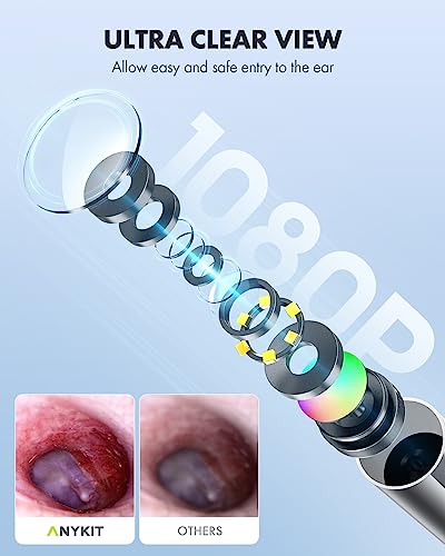 Digital Otoscope for Phone and Tablet with Ear Wax Removal Tools M3390