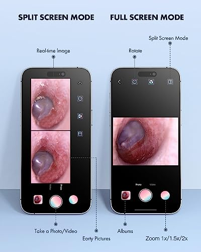 Digital Otoscope for Phone and Tablet with Ear Wax Removal Tools M3390
