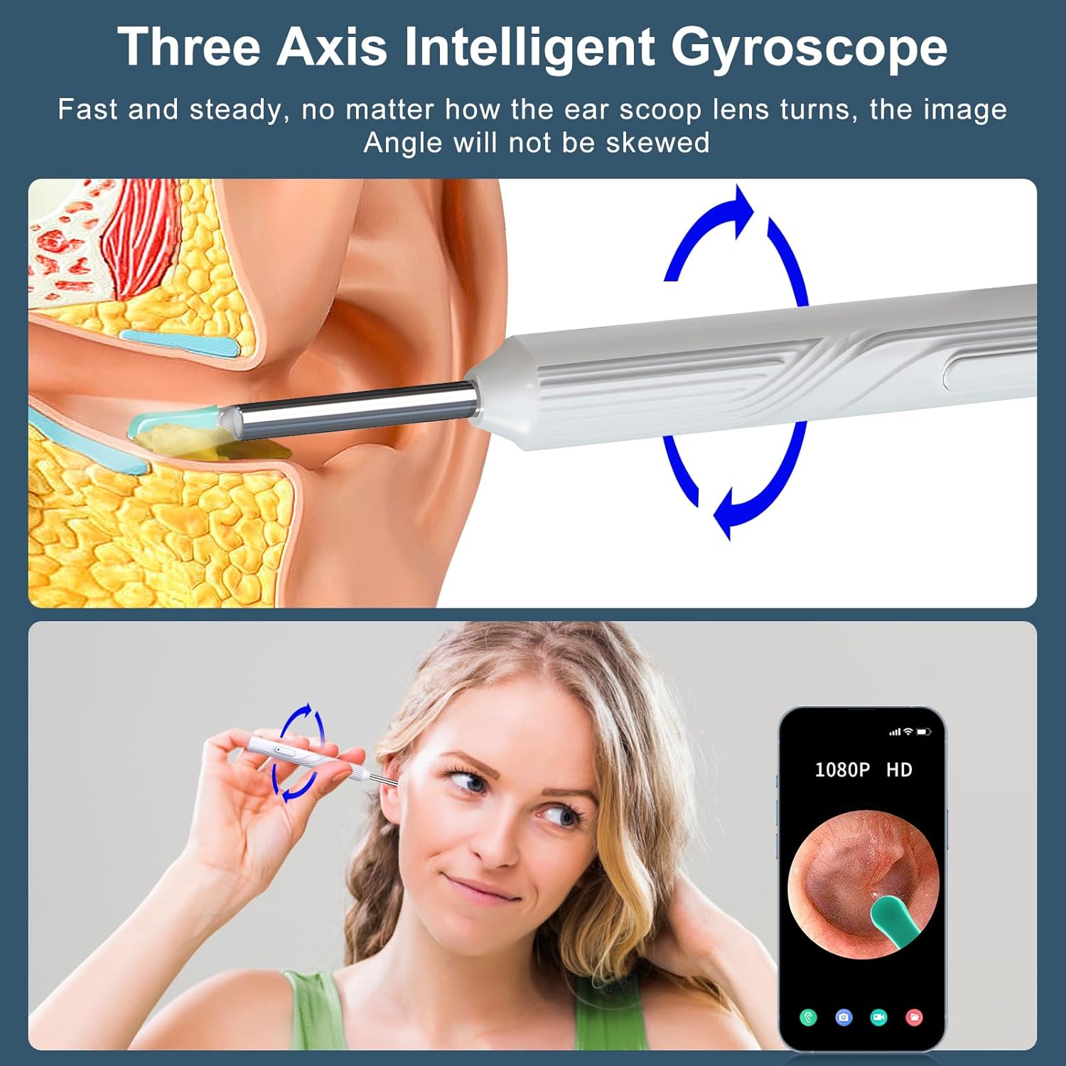 Ear Wax Removal Tool Camera with 8 Pcs Ear Set, 1080P HD Otoscope G522