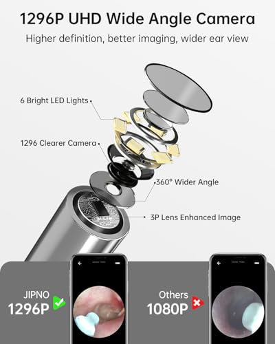 Ear Wax Removal Tool Camera with 6 LED Light, Ear Cleaning Kit for iPhone iPad Android K1307