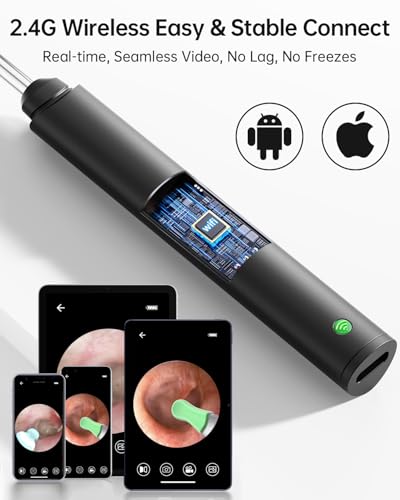 Ear Wax Removal Tool Camera with 6 LED Light, Ear Cleaning Kit for iPhone iPad Android K1307
