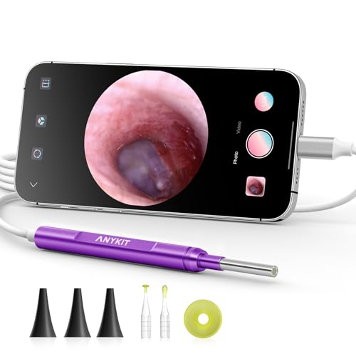 Anykit Digital Otoscope for Phone & Tablet, Ultra Clear View Ear Camera with Ear Wax Removal Tools, Video Ear Scope Otoscope with Light, Support Capture Photo & Record Videos