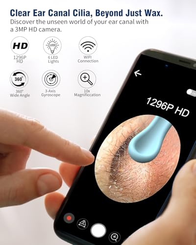 Ear Wax Removal Camera, Wireless WiFi Otoscope with 6 Lights, Rechargeable Ear Cleaner Kit B8407
