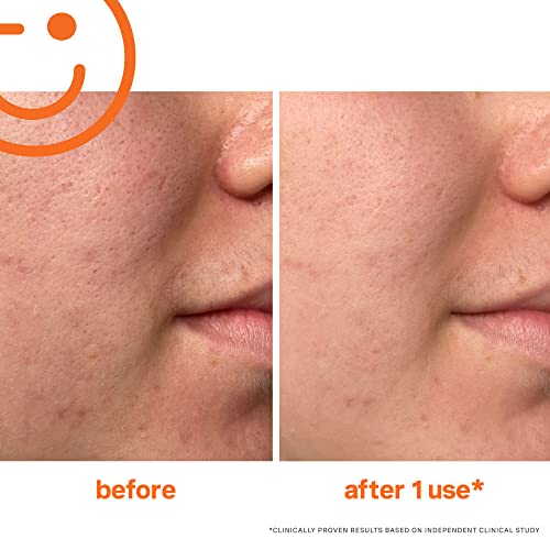 Exfoliating Facial Scrub with Salicylic and Lactic Acid V256