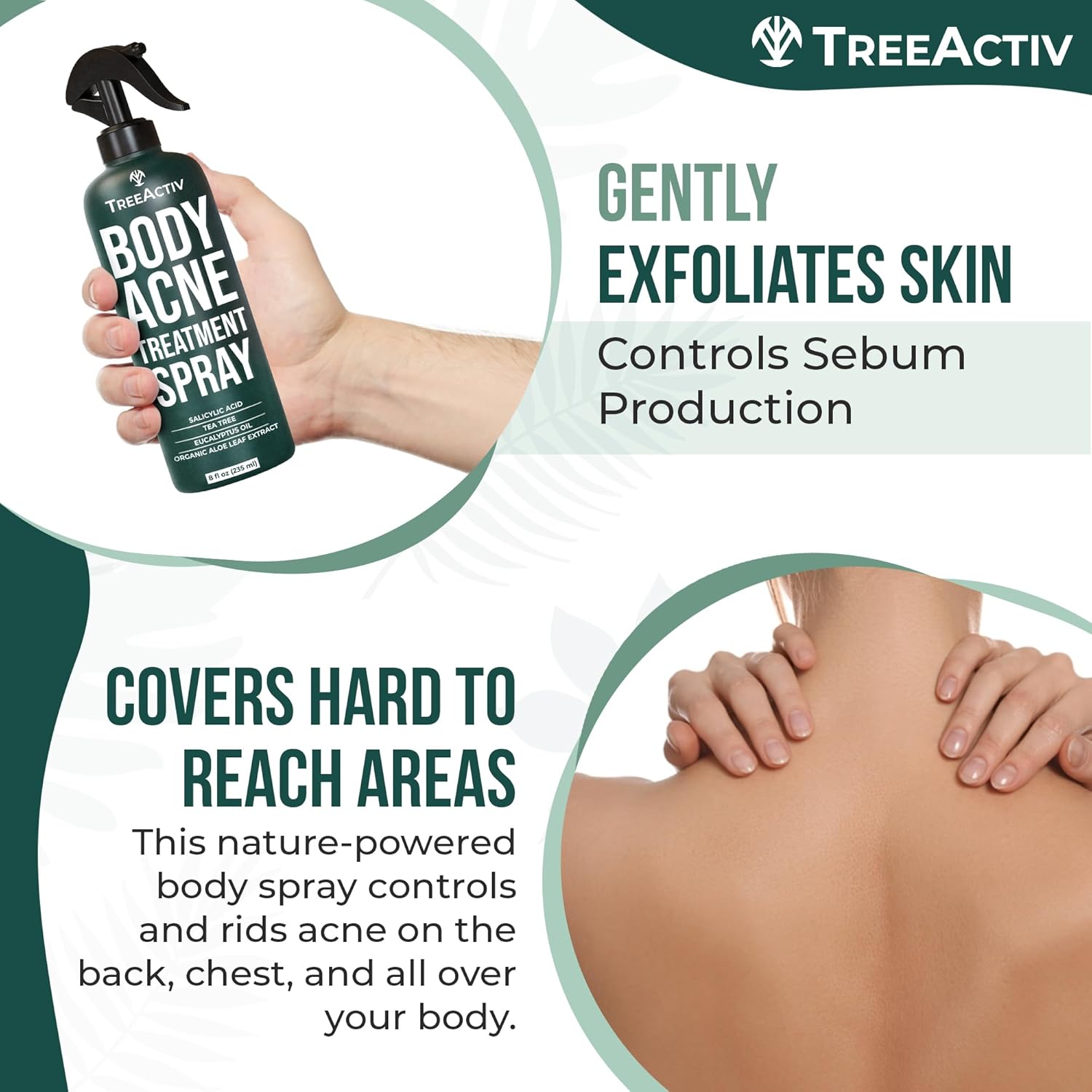Body Acne Treatment Spray with Salicylic Acid and Tea Tree Oil E351