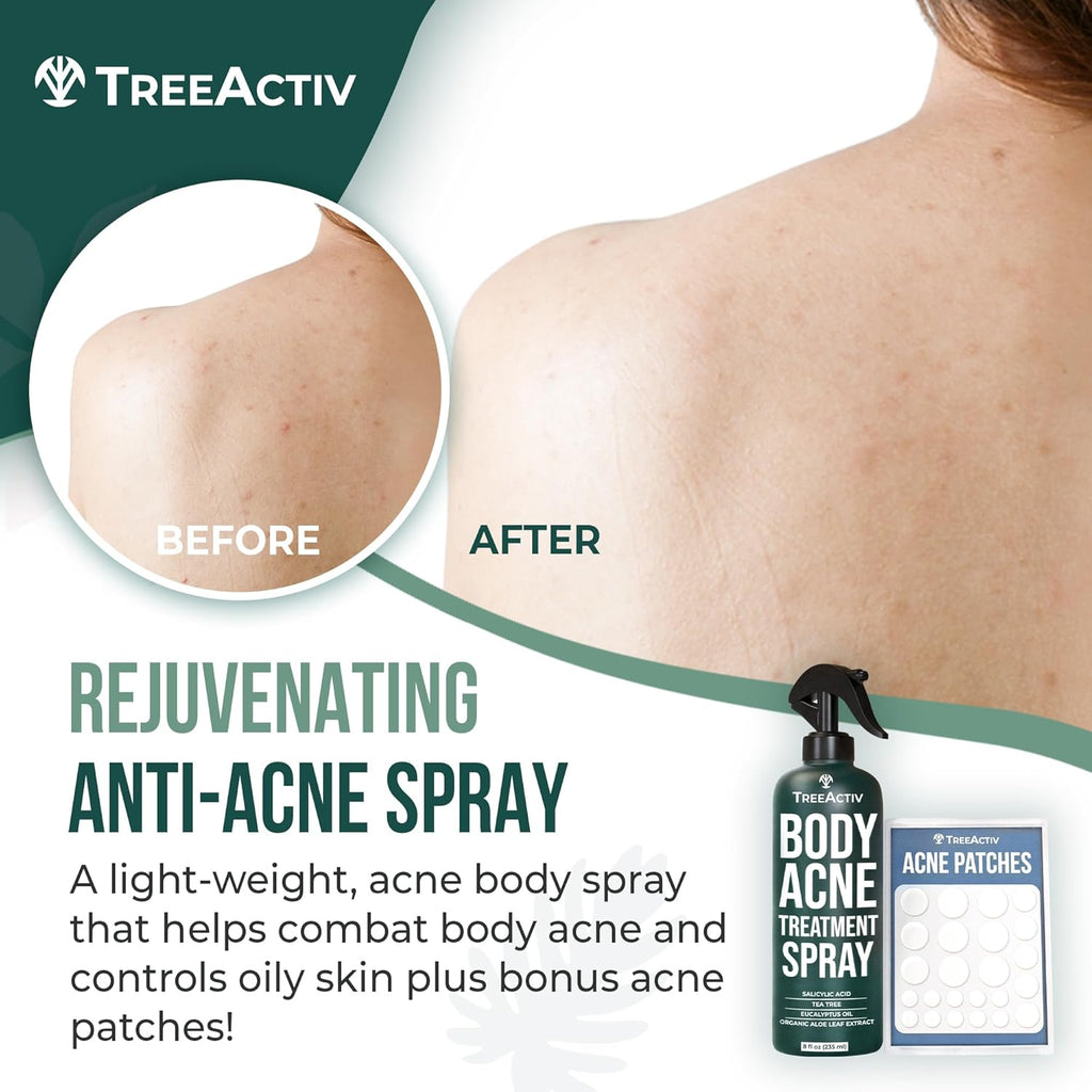 Body Acne Treatment Spray with Salicylic Acid and Tea Tree Oil E351