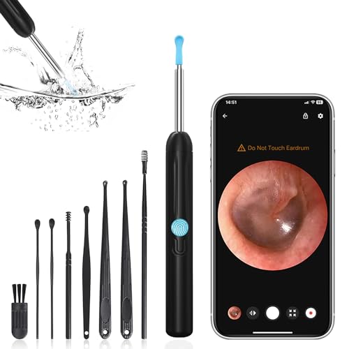 Ear Wax Removal - Ear Cleaner with Camera - Earwax Remover Tool with 8 Pcs Ear Set - Wireless Ear Scope Otoscope with Light - Ear Camera with 6 Ear Spoon - Ear Cleaner (Black)